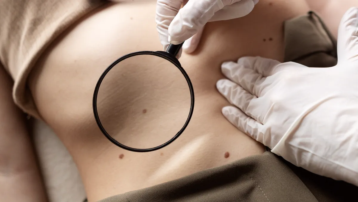 Médico examinando pinta com lupa